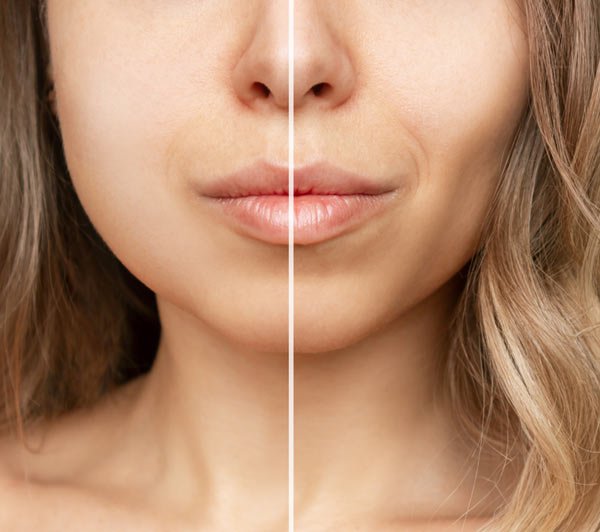 עיצוב והדגשת עצם הלחי