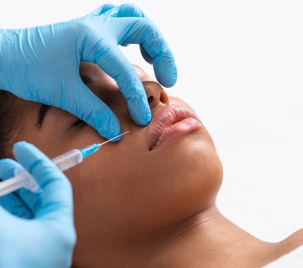 "מילוי קמטי "ברקוד