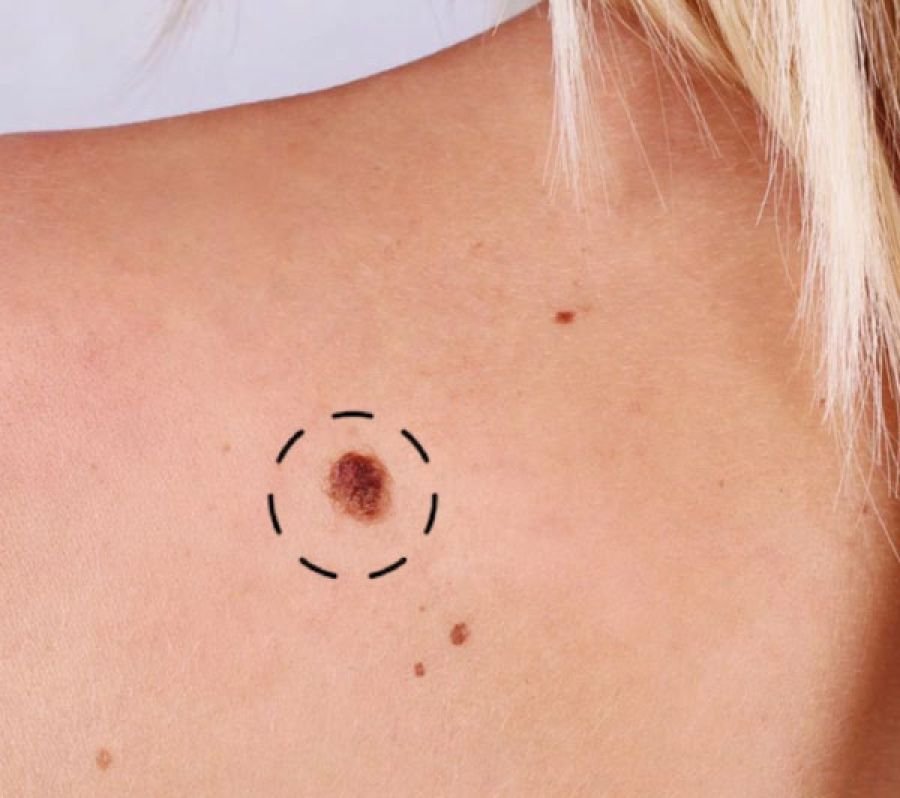 כירורגיה זעירה