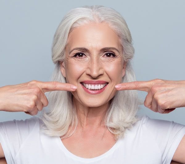 מילוי קמטי הסוגריים והמריונט נעשה